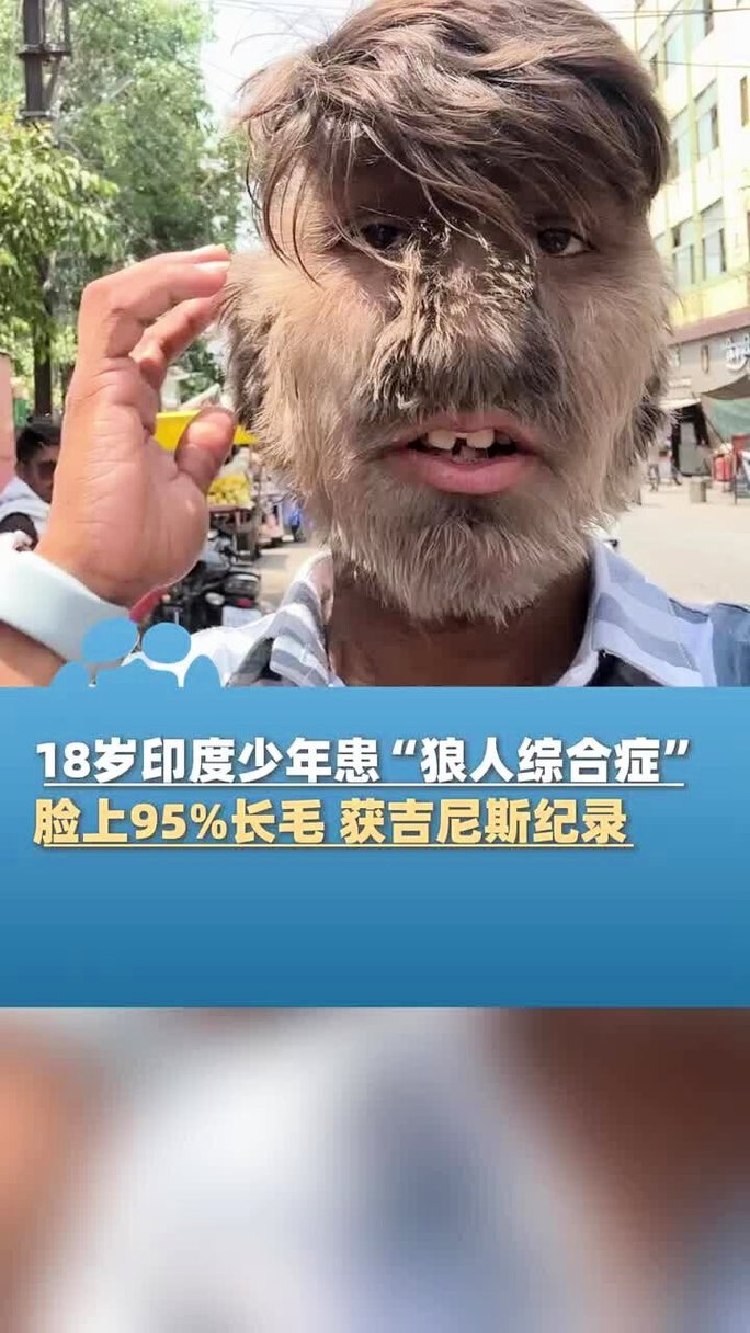 亚洲美女被黑人干的相关介绍